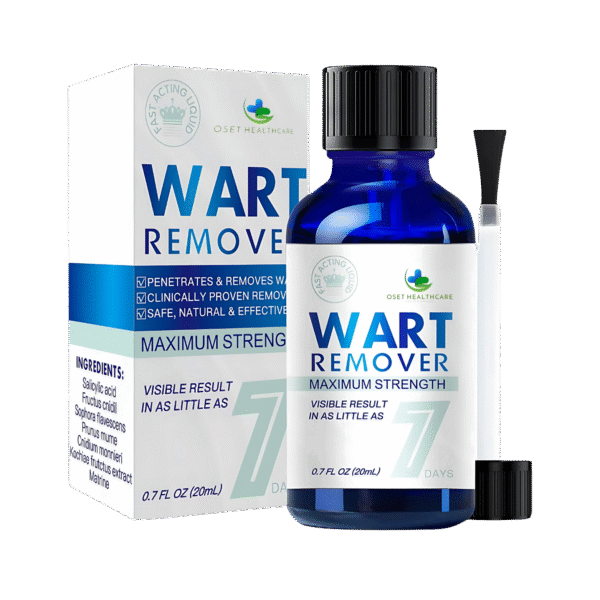 OSET WART REMOVER