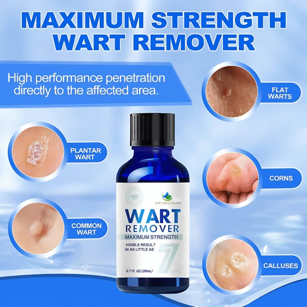 OSET WART REMOVER - Image 3